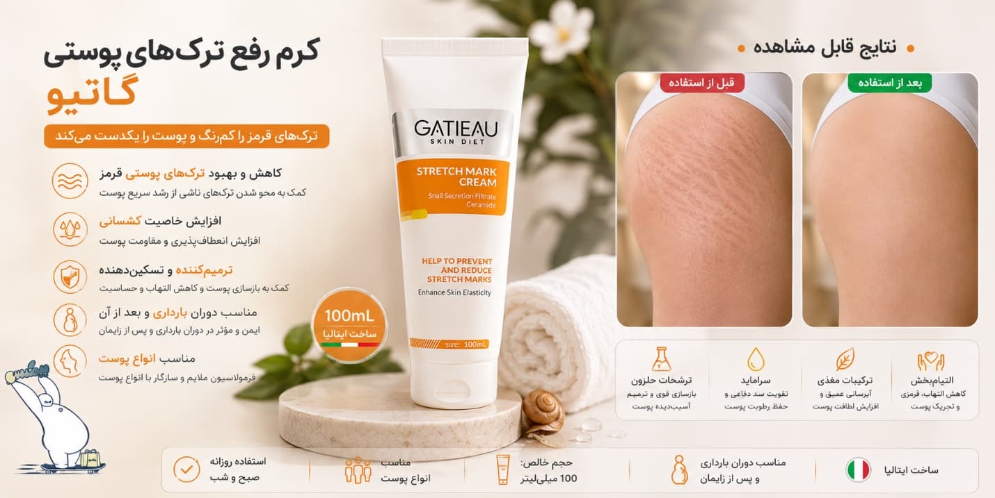 رفع ترک پوستی (استرچ مارک)؛ روش‌ های موثر برای درمان و کاهش آن
