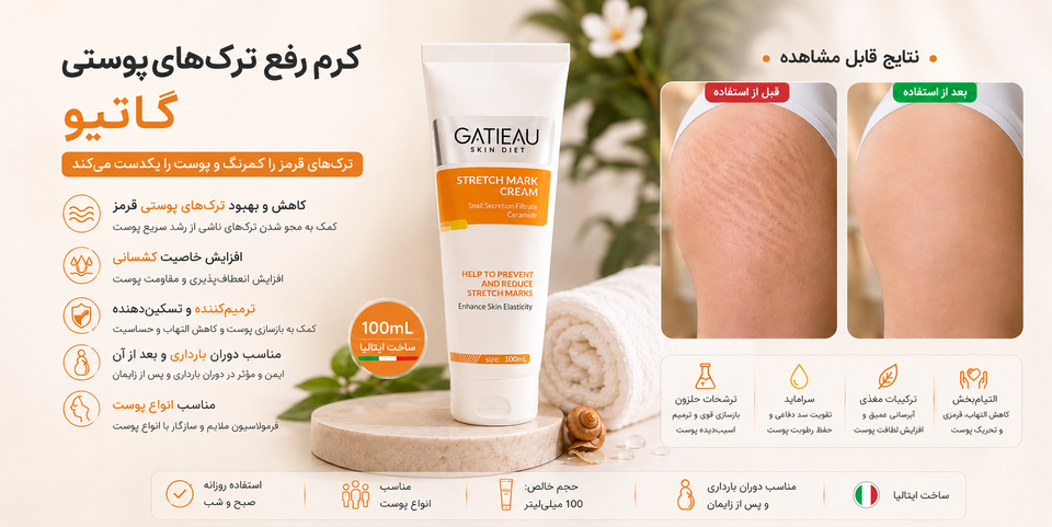 رفع ترک پوستی (استرچ مارک)؛ روش های موثر برای درمان و کاهش آن