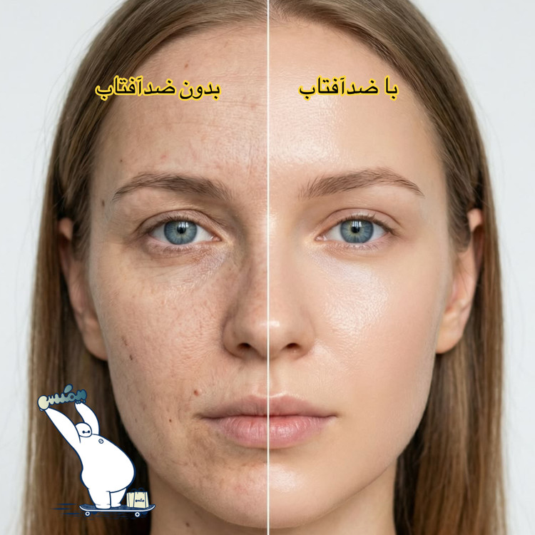 کرم ضد آفتاب لاکچری کوین SPF50 مناسب پوست چرب