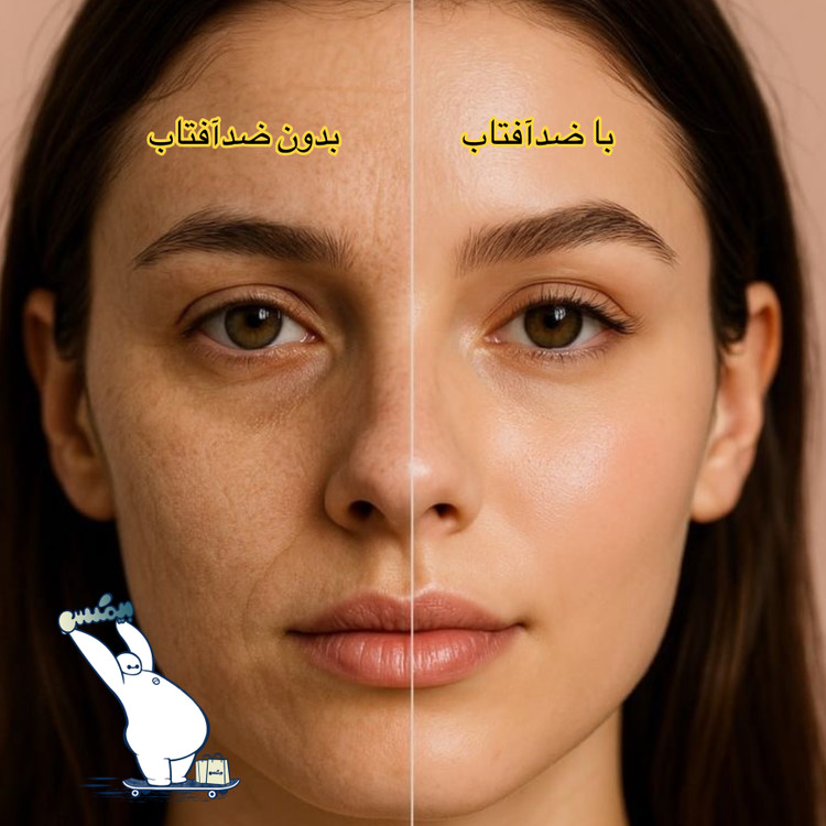 کرم ضد آفتاب لاکچری کوین SPF30 مناسب پوست خشک و حساس | اورجینال فرانسه
