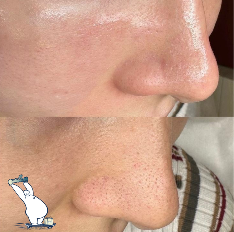 سرم لایه بردار لاکچری کوین