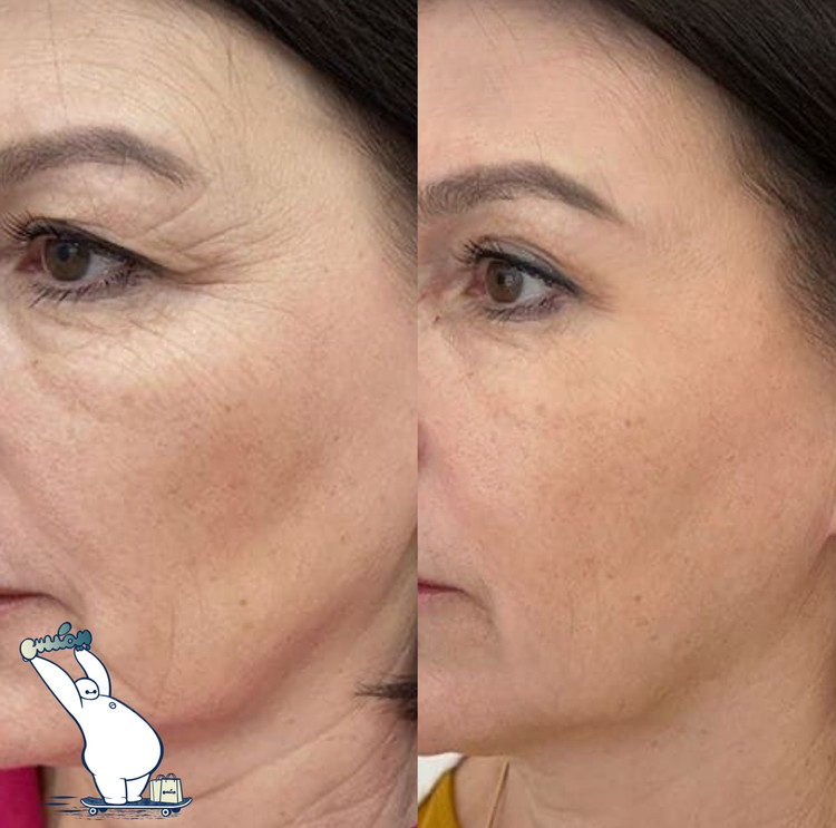 پودر کلاژن لاکچری کوین