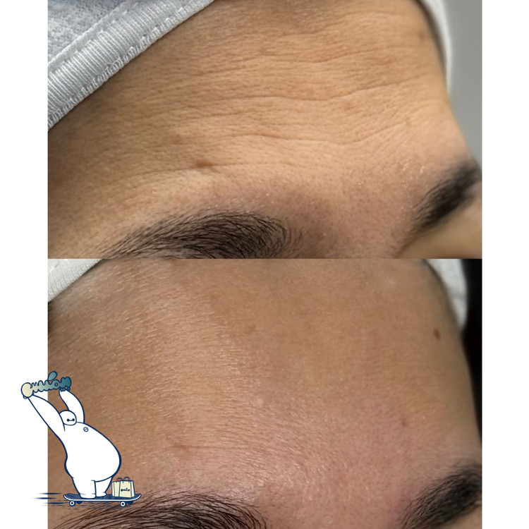 سرم ژل کلاژن لاکچری کوین