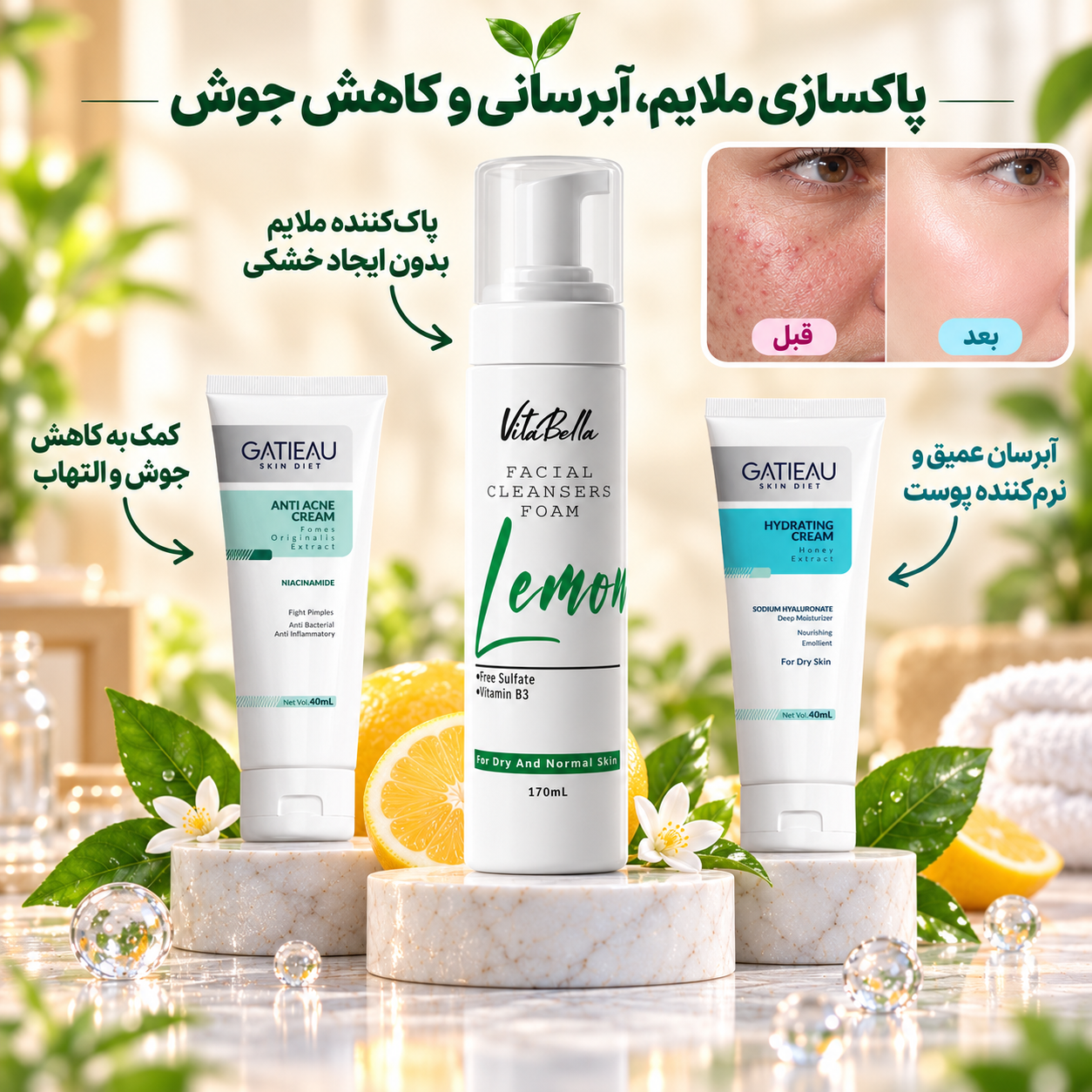 پک ضد جوش پوست خشک؛ پاکسازی، درمان و آبرسانی