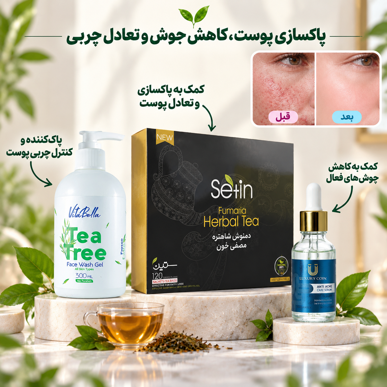 پک ضد جوش هورمونی؛ پاکسازی و مراقبت تخصصی پوست