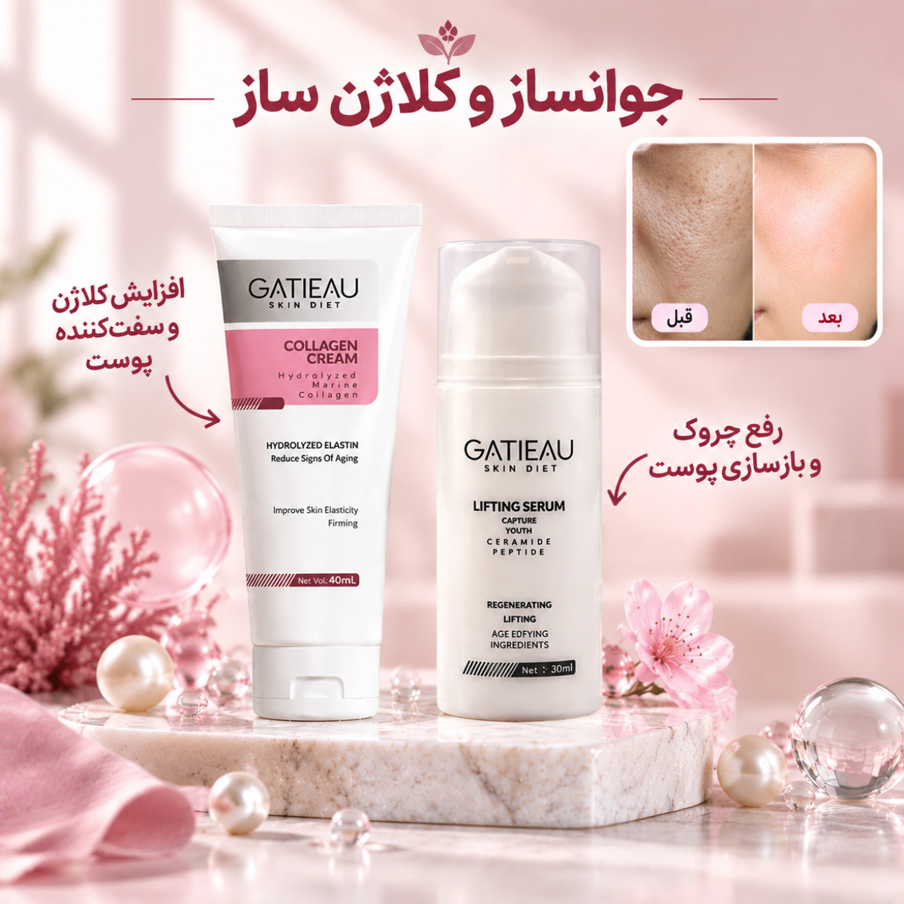 پک لیفت و کلاژن‌سازی گاتیو